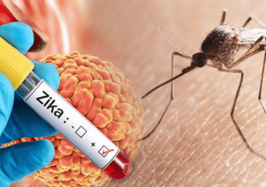 Zika Virus