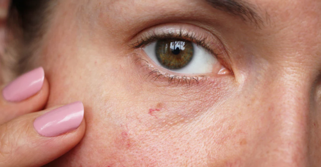 Skincare Tips: