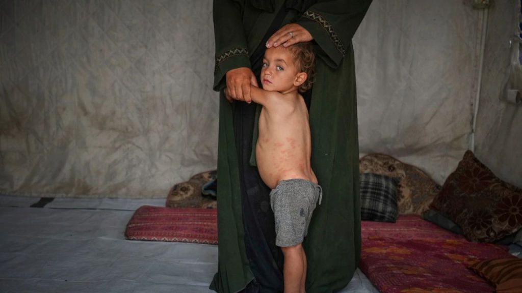 Gaza: जॉर्डन में इज़रायली रोक से सड़ गया खाना, गाजा में बच्चे भूख से बिलबिलाए 1 gaza 1