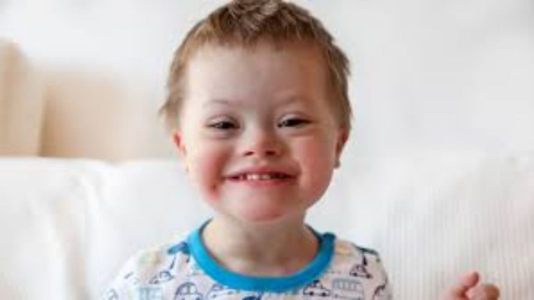 DOWN SYNDROME