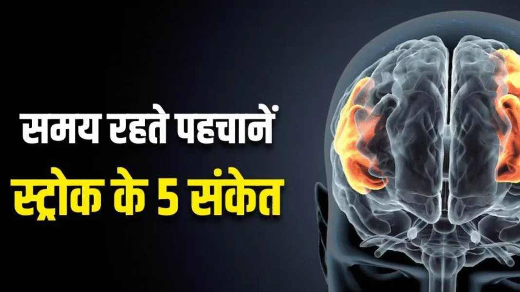 Stroke Warning Signs