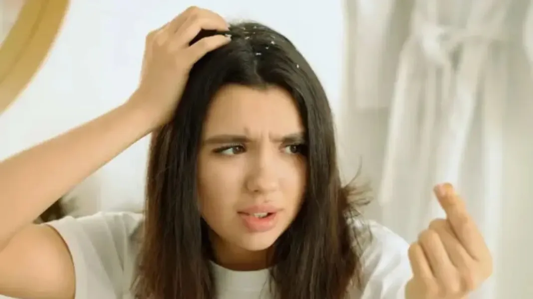 Winter hair care tips December 2025.jpg